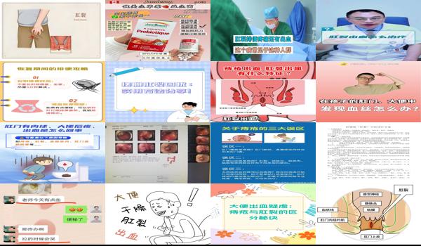 月子肛裂出血怎么治愈 - 汕头月子肛裂出血怎么办