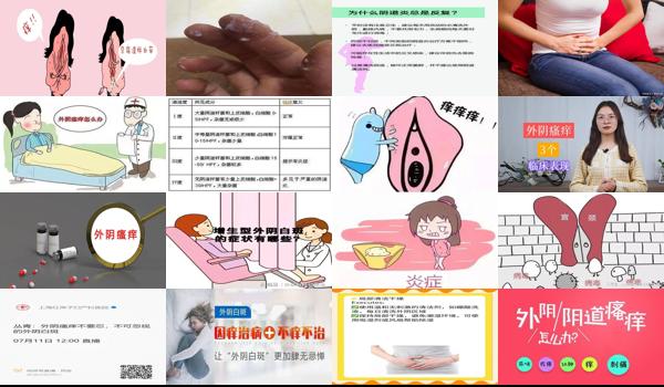 下面外头痒 - 汕头外阴瘙痒会不孕吗