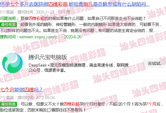 汕头七个月胎儿四维彩超