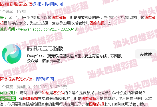汕头四维彩超怎样做