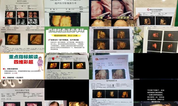 汕头四维彩超怎样做