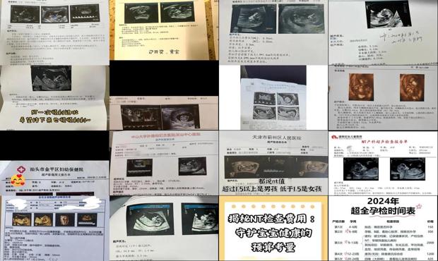 汕头nt检查多少钱