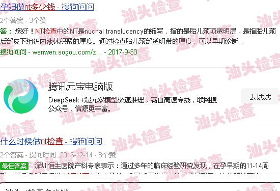 汕头nt检查多少钱