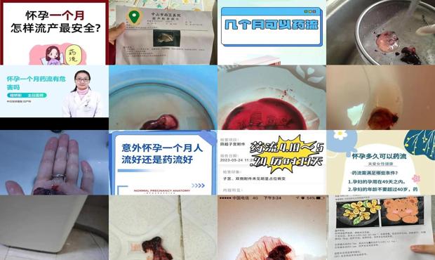 汕头怀孕一个月可以药流