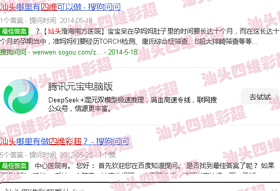 汕头四维彩超看什么