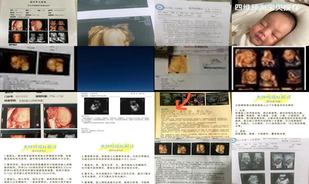汕头四维彩超准确*
